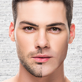 Stubble Attachment